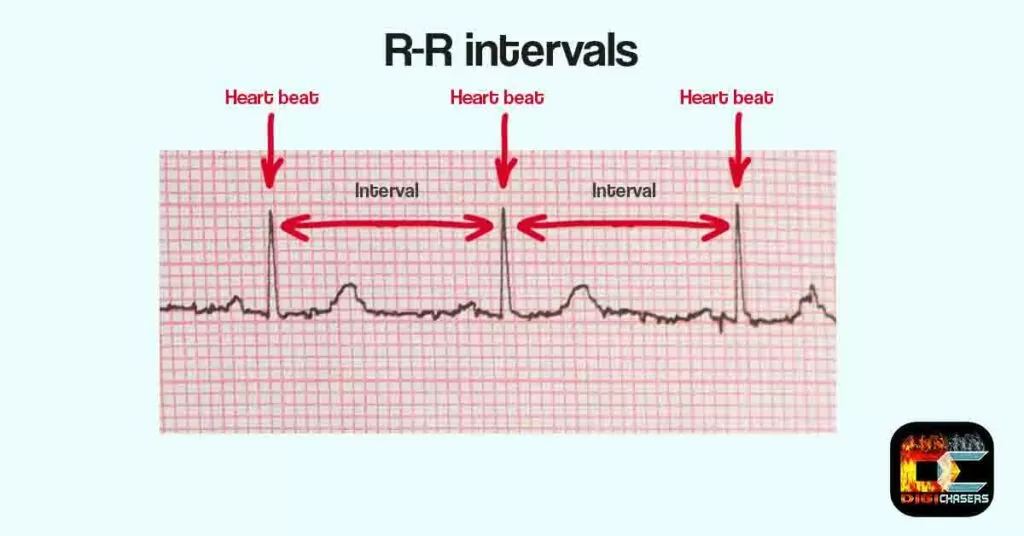 HRV interval in picture
